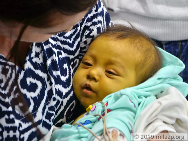 Baby Rukhsorabonu needs your help urgently