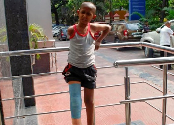 Farhan Needs Your Help To Save His Leg From Cancer