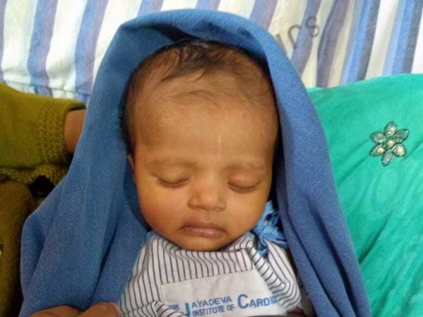 Save Shravya – Four Months Baby Having Three Holes in her Little Heart