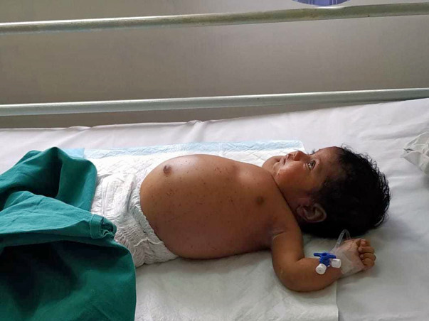 Help 2-month-old Baby Recover From Skin Cancer