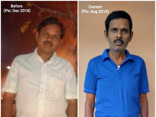 Help Ramesh Undergo Liver Transplantation