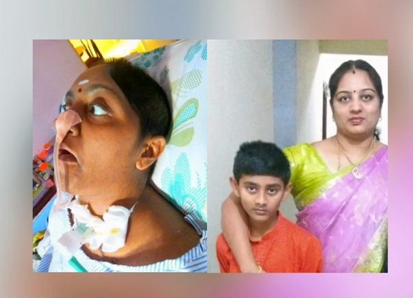 Save Suba, Mother Of My 8-Year-Old Son to Recover From Brain Damage