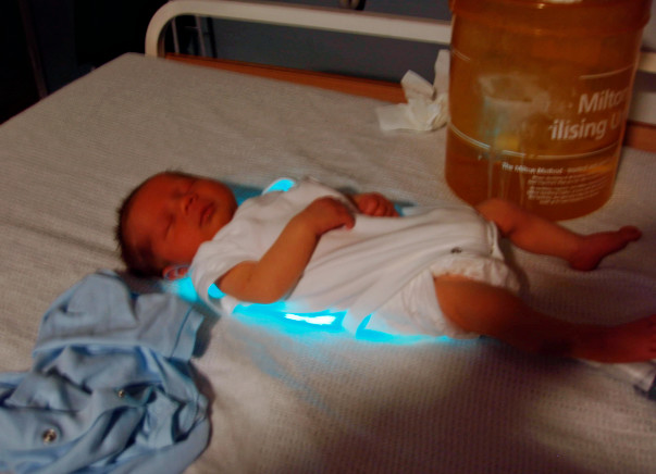 Help India fight Jaundice in Newborn