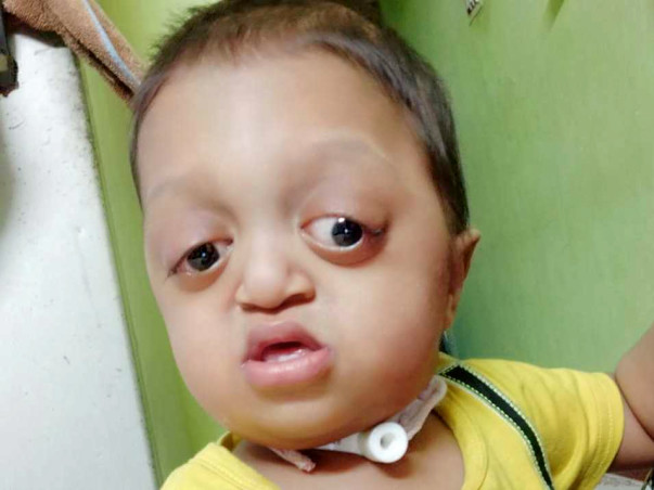 Let’s Help This Baby To Lead His Life - Muhammad Ibrahim