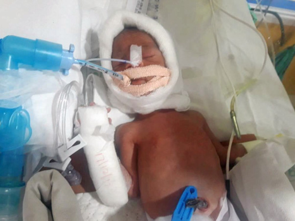Help Mona and her Premature Infant