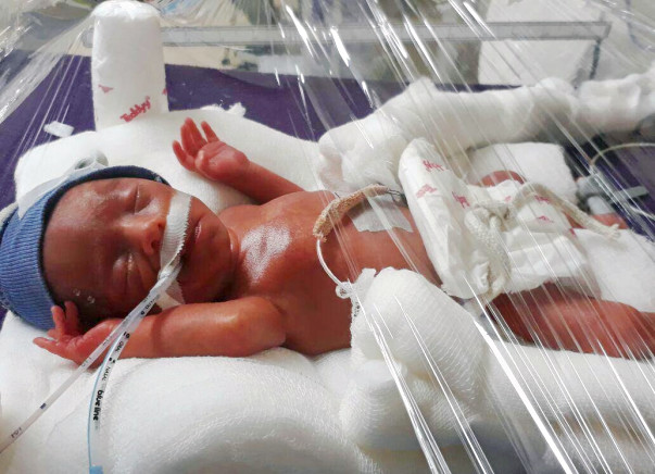 Please Save My One-month-old Baby Boy