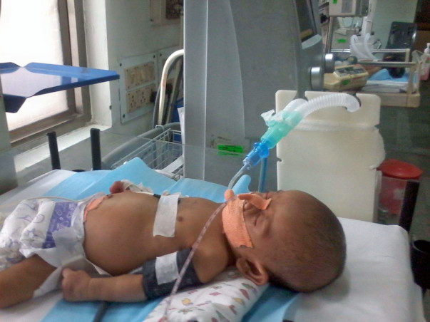Help save baby Ghansham who's fighting against Shock& respiratory fail