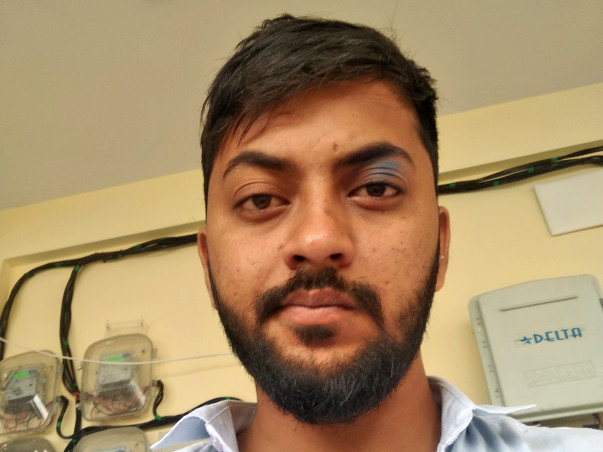 Help me to fight kidney stone