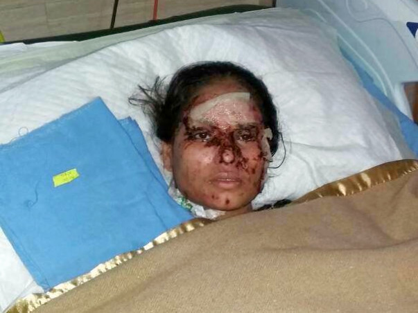 In Memory of Salma, Saving Relief Fund For Acute Acid Attack Cases