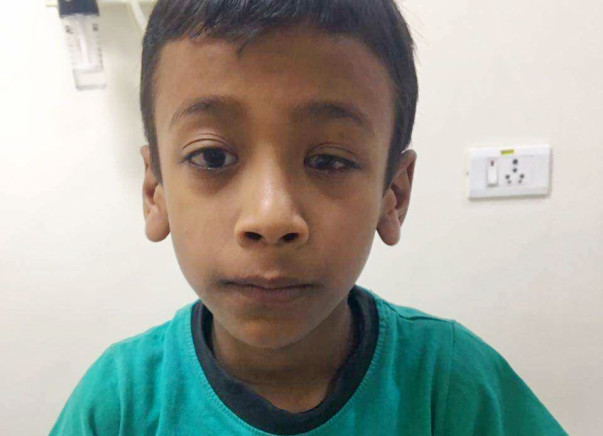 Help master Krishna get cochlear implant