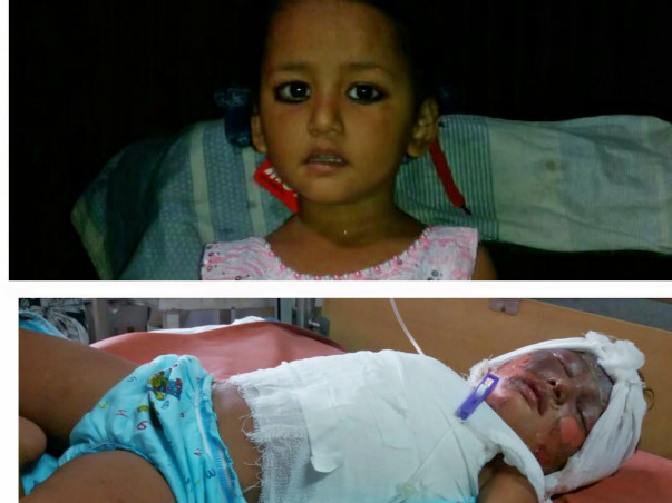 3-Year-Old Poornima Needs OurHelp