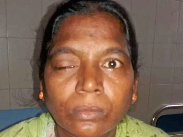 Help My Mother Fight Neuro Disease