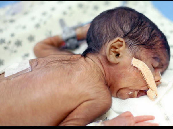 My baby can’t breathe without ventilator support and I can’t fund her