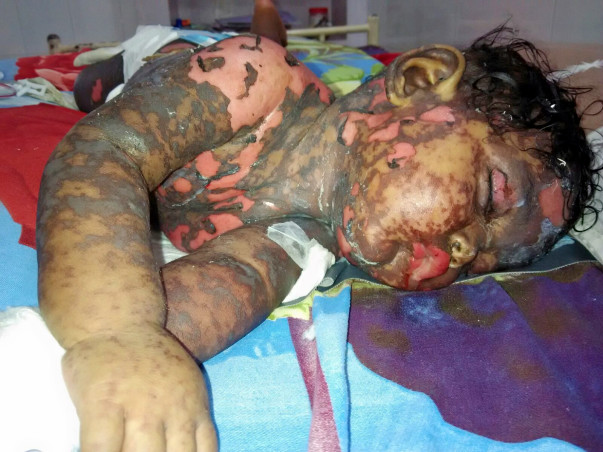 I am fundraising to help to save this 7 months old baby