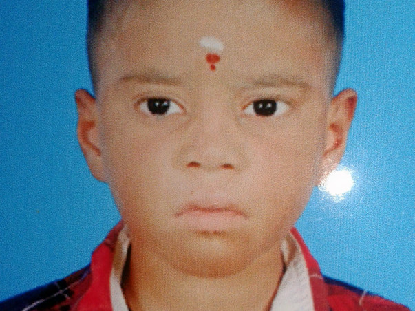 Need money to baby operation