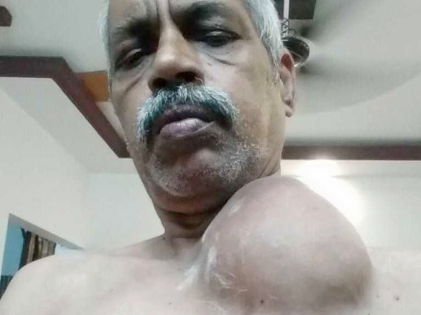 Help Raghunadh Garu Fight Cancer