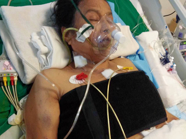 Help My Friend's Mother's Heart Bypass Surgery
