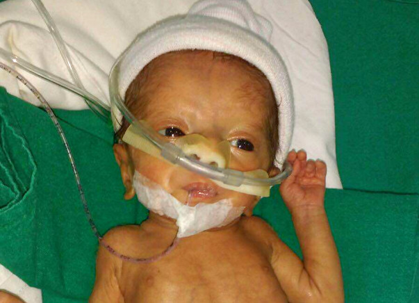 Help this Uber partner save his 7 month old pre-mature baby