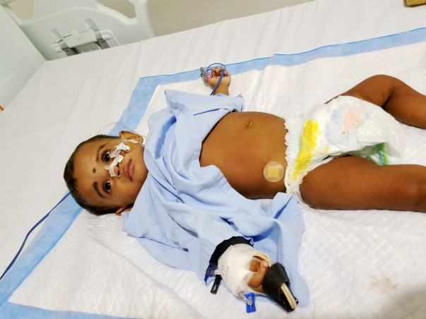 1-year-old Vyga with a swollen stomach needs help
