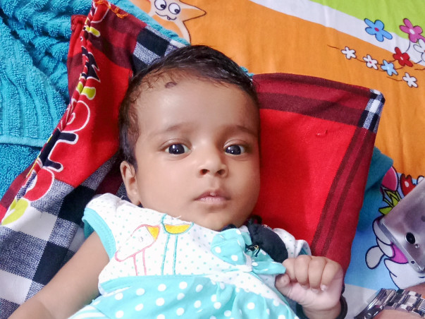 Help 3 Month Old Baby Undergo Liver Transplant