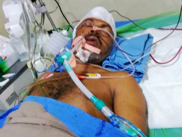 Help My Brother Who Is Undergoing For Brain Treatment