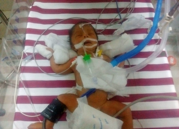 This Couple Needs Your Support To Save Their 3 Day-Old-Baby