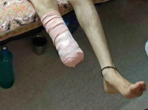 Help Ahmad Be Normal Again