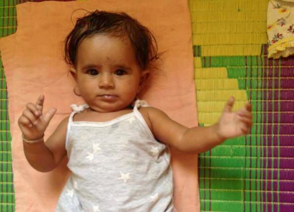 Fund Raising For Congenital Heart Surgery Of Child