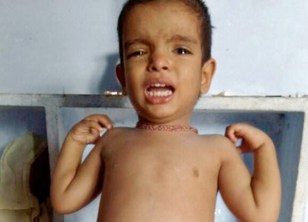 When We See Our Son Unable To Eat Basic Liquid Food,We Stop Eating Too