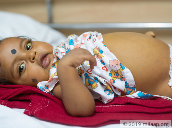 Projwal needs your help for Liver transplant surgery