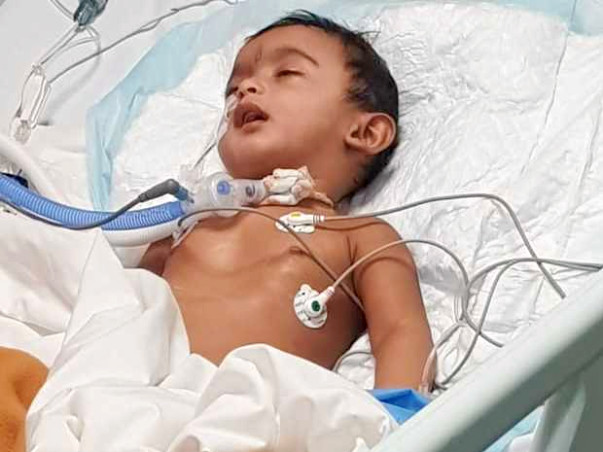 9 Months Old Baby Of Shruthi Needs Your Help Fight Pierre Robin Sequence