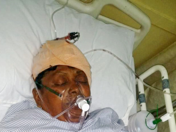 Please Save The Mother Suffering From Brain Tumour