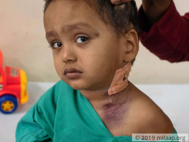 2-Year-Old's Parents Can't Afford The Only Cure For His Rare Disease