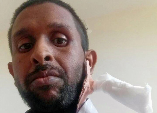 Help Murtuja Undergo Dialysis For His Kidney Failure