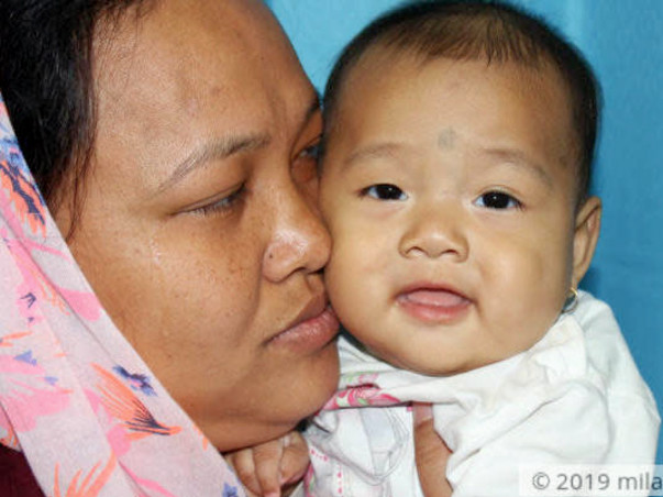 Baby Andrina needs your help to survive