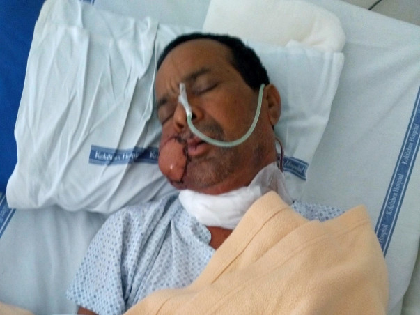 PLEASE HELP MY FATHER TO FIGHT WITH CANCER