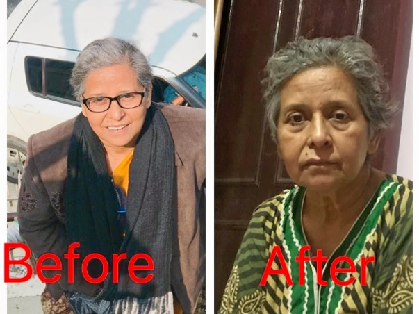 Help Basant Shobha For Fight With Hodgkin's Lymphadinitis Cancer