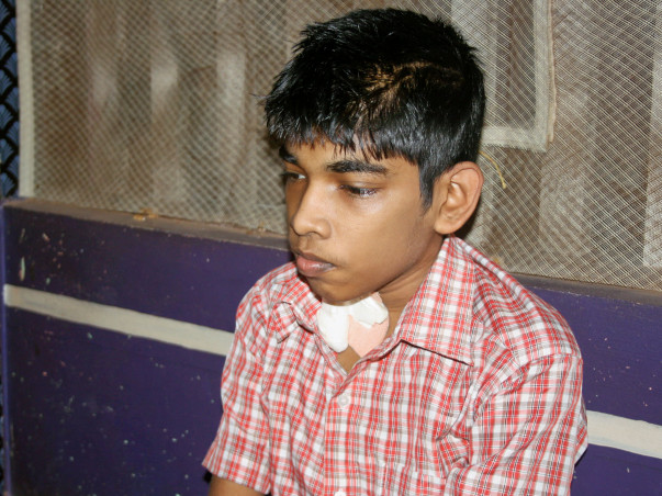 Help 16 Year Ritesh For Treatment Of Kidney Transplantation