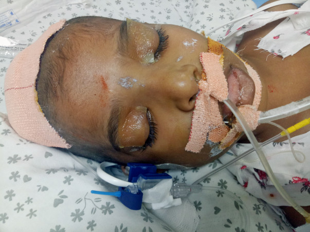 Help Ram Recover From A Critical Brain Disease