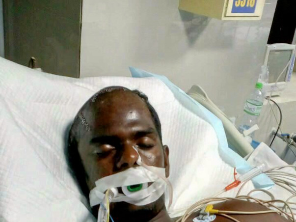 Severe head injury for my brother.He is in very critical stage.Help us