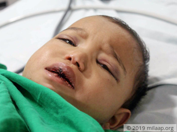 Help Gauri Fight Acute Myeloid Leukemia