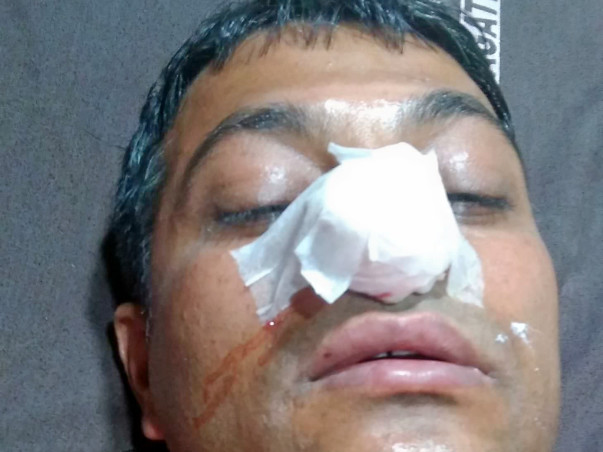 Help Me For My Hepatitis Treatment