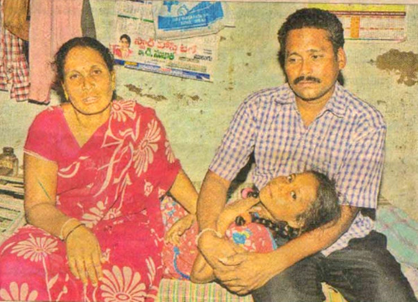 Please help 13 year old Jahnavi, she needs kidney transplantation