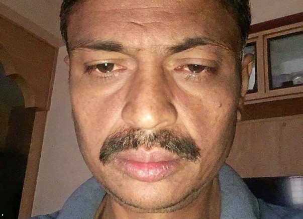 Help 44-Year-Old Man Undergo Liver Transplant