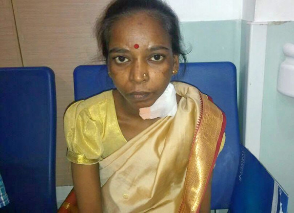 Help Sucheta Undergo A Kidney Transplant