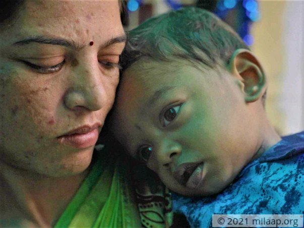 Parents Starve To Feed 1-Year-Old Who Could Die Of Malnutrition