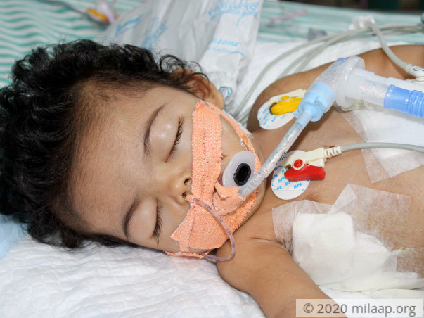 Baby Girl Who Can't Eat Or Breathe Needs Urgent Help To Live