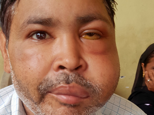 Help Neeraj Recover From Lymphoma