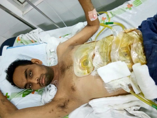 Help 22-Year-Old Mehul Fight Faecal Fistula