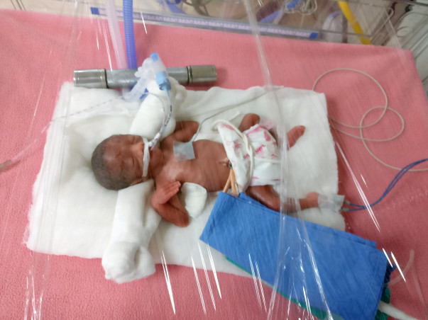 Help Sujata and Pravin save ther prematurely born babies
